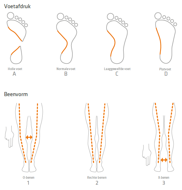 Inlegzolen de oplossing voor pijnlijke voeten en knie n tijden